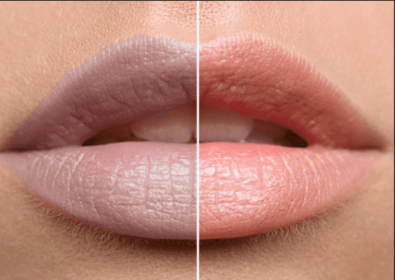 son thuần chay có gây thâm môi không